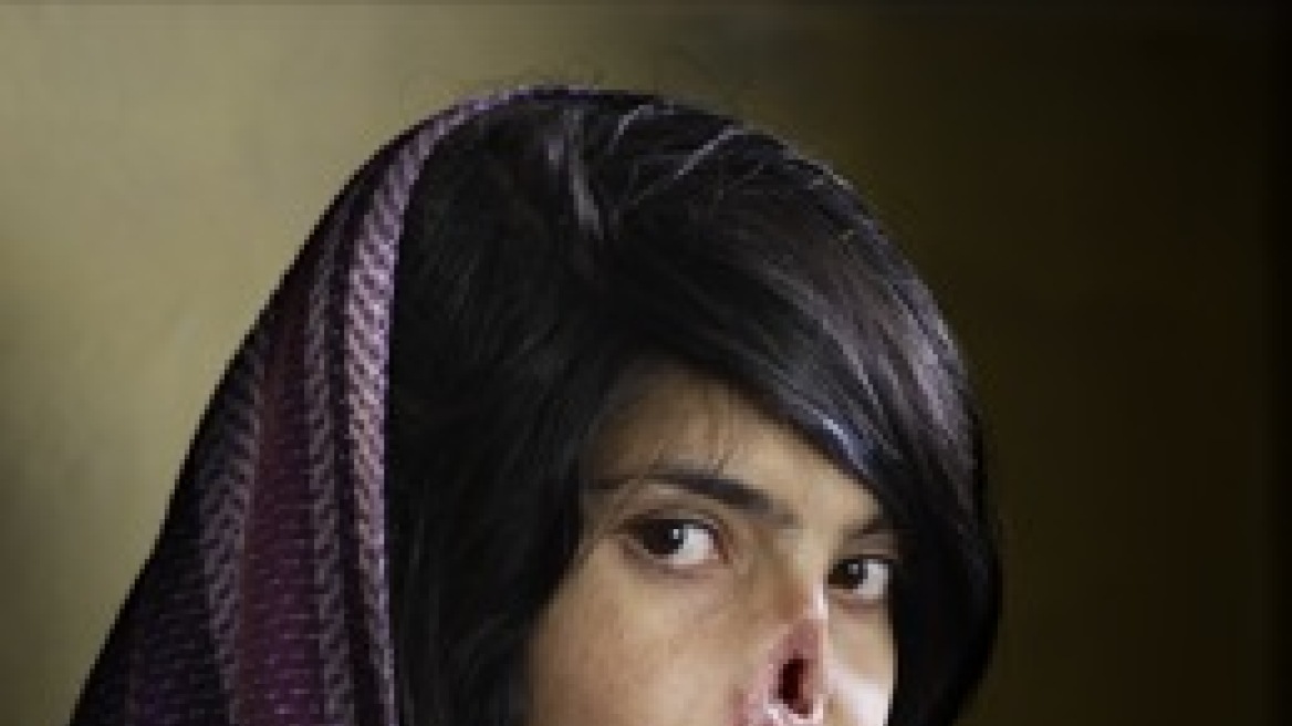Βραβείο World Press Photo για την ακρωτηριασμένη Αφγανή